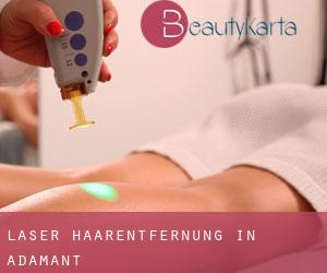 Laser-Haarentfernung in Adamant