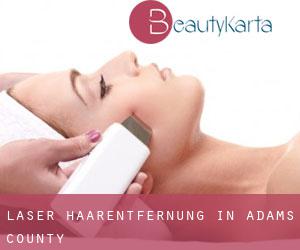 Laser-Haarentfernung in Adams County