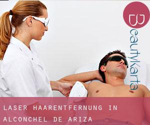 Laser-Haarentfernung in Alconchel de Ariza