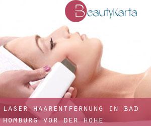 Laser-Haarentfernung in Bad Homburg vor der Höhe