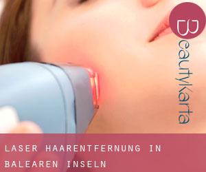 Laser-Haarentfernung in Balearen Inseln