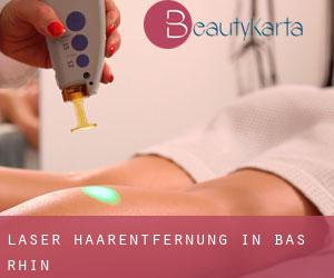 Laser-Haarentfernung in Bas-Rhin Laser-Haarentfernung in Bas-Rhin