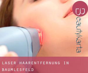 Laser-Haarentfernung in Bäumlesfeld Laser-Haarentfernung in Bäumlesfeld