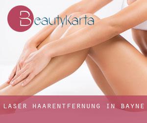 Laser-Haarentfernung in Bayne Laser-Haarentfernung in Bayne