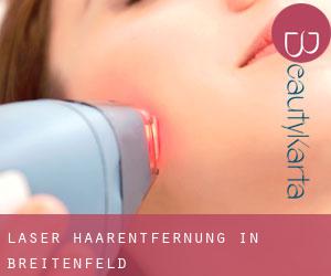 Laser-Haarentfernung in Breitenfeld