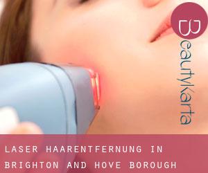 Laser-Haarentfernung in Brighton and Hove (Borough)