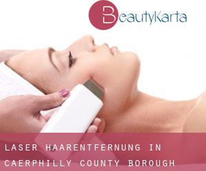 Laser-Haarentfernung in Caerphilly (County Borough) Laser-Haarentfernung in Caerphilly (County Borough)