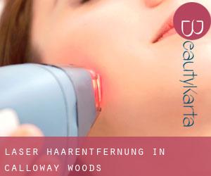 Laser-Haarentfernung in Calloway Woods Laser-Haarentfernung in Calloway Woods