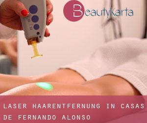 Laser-Haarentfernung in Casas de Fernando Alonso