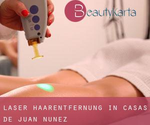 Laser-Haarentfernung in Casas de Juan Núñez