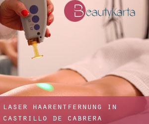 Laser-Haarentfernung in Castrillo de Cabrera