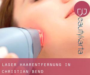 Laser-Haarentfernung in Christian Bend