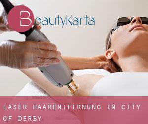 Laser-Haarentfernung in City of Derby