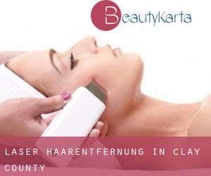 Laser-Haarentfernung in Clay County