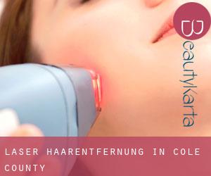 Laser-Haarentfernung in Cole County