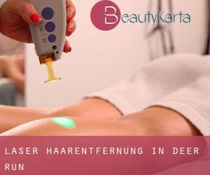 Laser-Haarentfernung in Deer Run