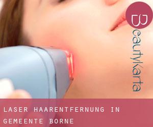 Laser-Haarentfernung in Gemeente Borne