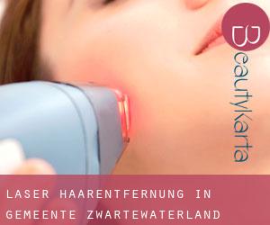 Laser-Haarentfernung in Gemeente Zwartewaterland