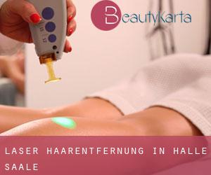 Laser-Haarentfernung in Halle (Saale)
