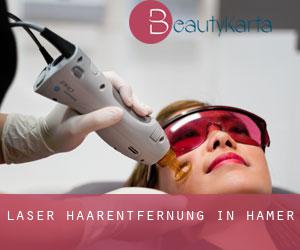 Laser-Haarentfernung in Hamer
