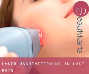 Laser-Haarentfernung in Haut-Rhin