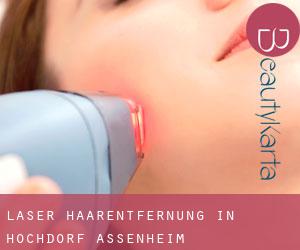 Laser-Haarentfernung in Hochdorf-Assenheim