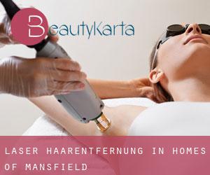 Laser-Haarentfernung in Homes of Mansfield