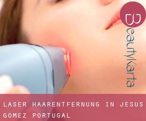 Laser-Haarentfernung in Jesús Gómez Portugal