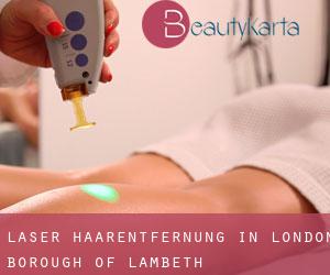 Laser-Haarentfernung in London Borough of Lambeth