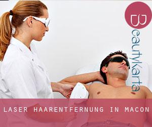 Laser-Haarentfernung in Macon Laser-Haarentfernung in Macon