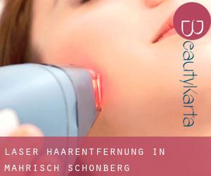 Laser-Haarentfernung in Mährisch-Schönberg