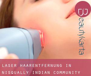 Laser-Haarentfernung in Nisqually Indian Community