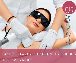 Laser-Haarentfernung in Puebla del Salvador