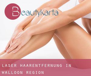 Laser-Haarentfernung in Walloon Region