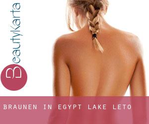 Bräunen in Egypt Lake-Leto