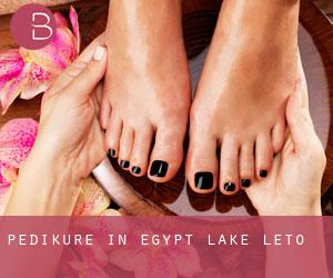Pediküre in Egypt Lake-Leto