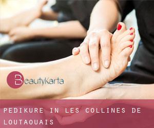 Pediküre in Les Collines-de-l'Outaouais Pediküre in Les Collines-de-l'Outaouais