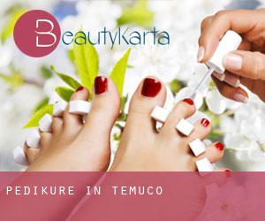 Pediküre in Temuco Pediküre in Temuco