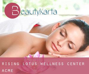 Rising Lotus Wellness Center (Acme)